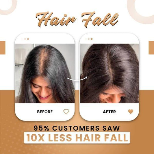 Premium Hair Oil for Hair Growth & Thickness – Anti Hair Fall Natural Oil 200ml - Smart Hud